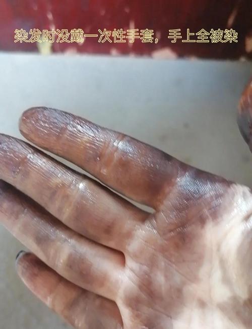 染发剂沾皮肤,怎么快速洗掉?