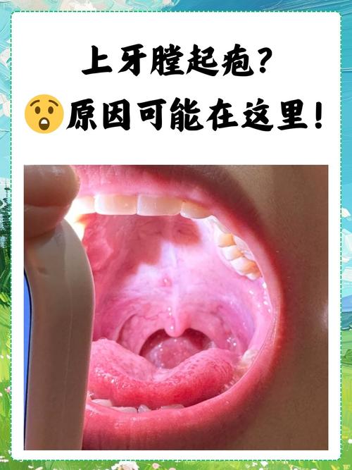 总是口腔溃疡,是身体在报警吗?