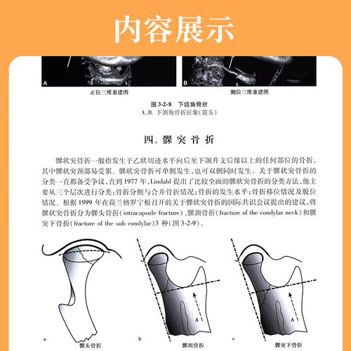 口腔CBCT拍片费用是多少?