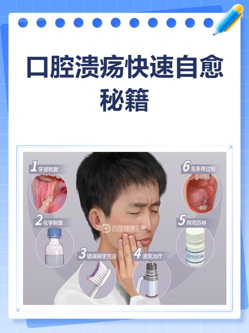 大面积口腔溃疡如何快速愈合?
