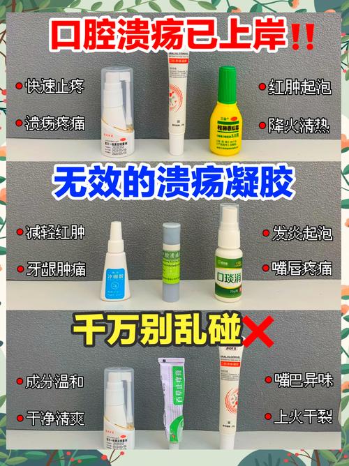 口腔溃疡最有效方法是什么?