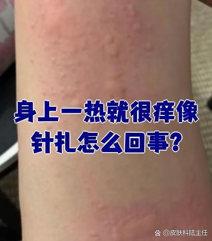 皮肤针扎疼是过敏还是神经问题?
