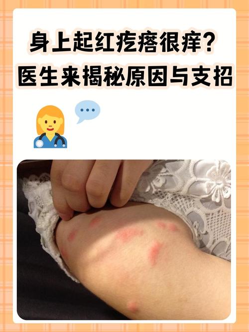 皮肤瘙痒起疙瘩是什么原因