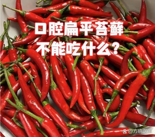 口腔扁平苔藓不能吃什么食物