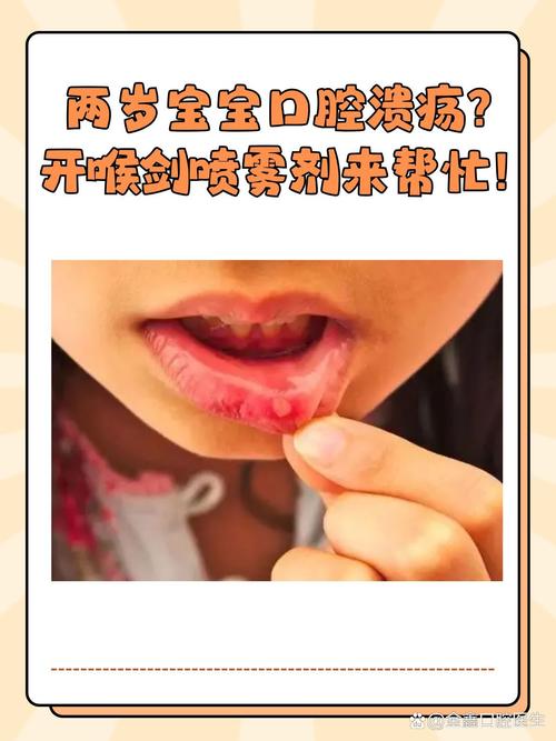 4个月宝宝口腔溃疡怎么办
