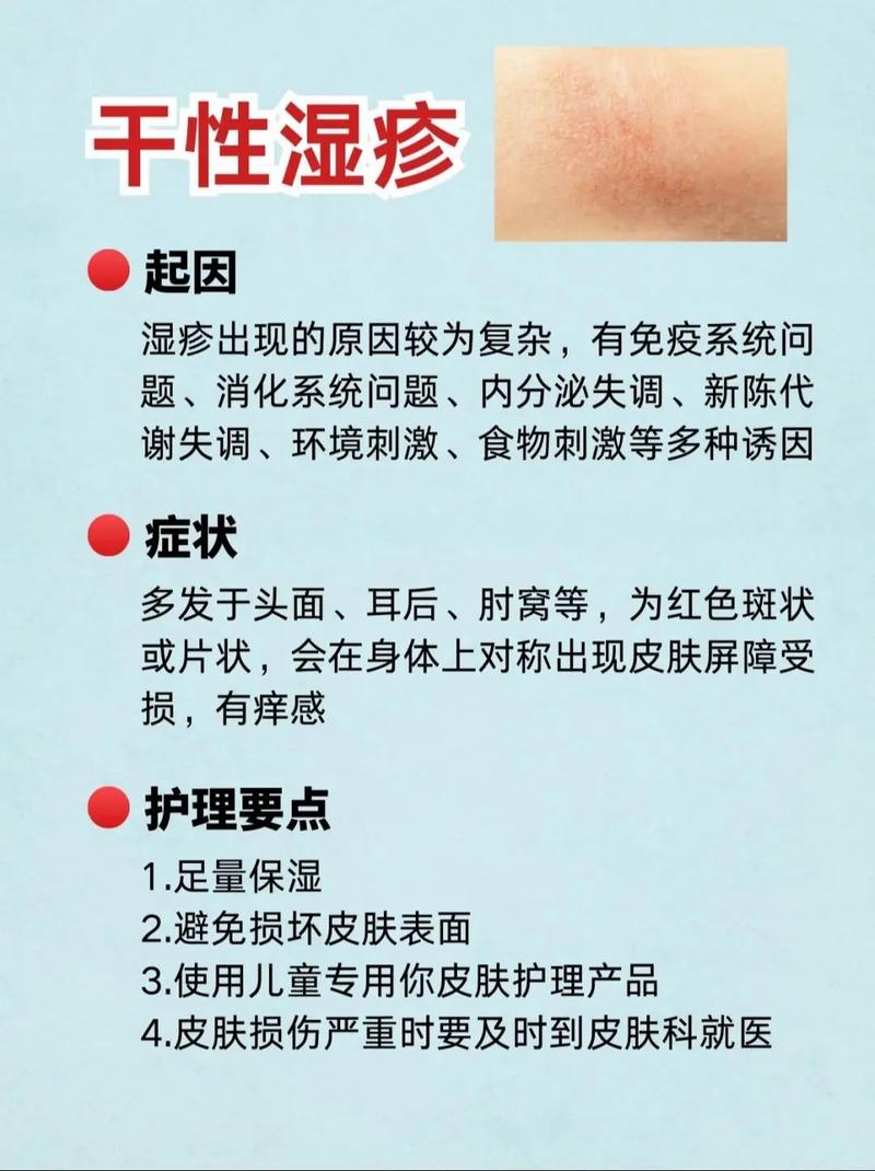 皮肤湿疹是什么原因引起的