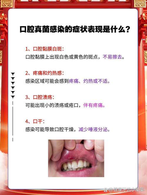 口腔发干是何因作祟?