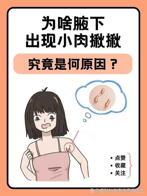 皮肤上长小肉疙瘩怎么回事