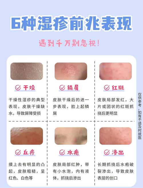 脸上皮肤过敏干燥,如何快速缓解?