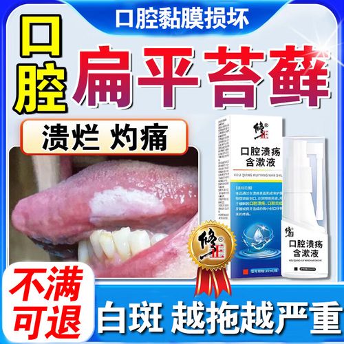 口腔扁平苔藓吃什么药管用