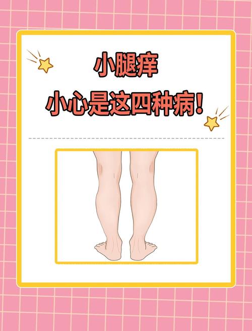 双下肢瘙痒,是皮肤病还是内科病?