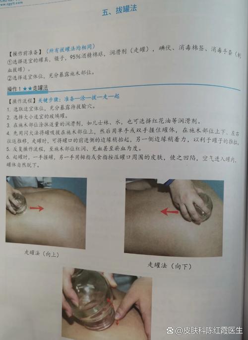 皮肤病中医西医,到底怎么选?