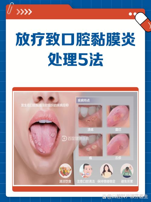 化疗口腔溃疡怎么办?