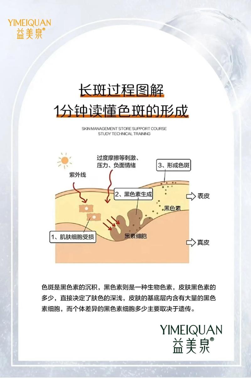 皮肤长斑背后,藏着哪些健康密码?