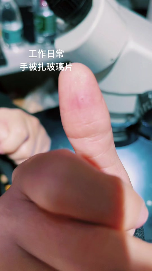 玻璃丝扎进皮肤怎么取?小刺难清怎么办?