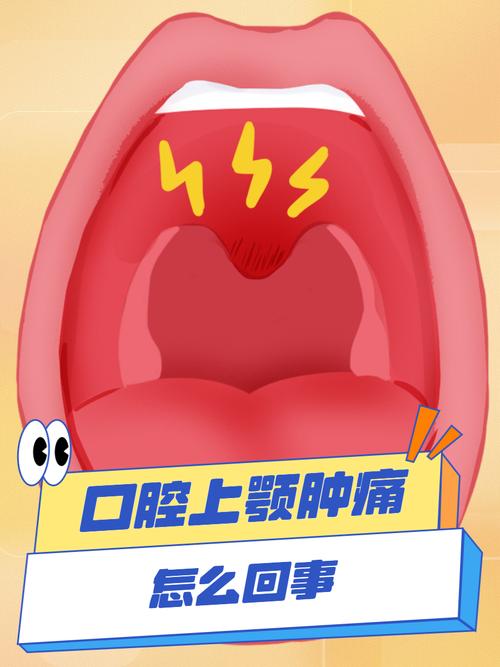上颚疼,是口腔问题还是其他原因?