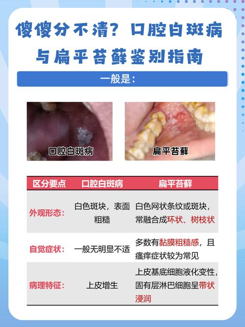 口腔内壁白斑是何原因?