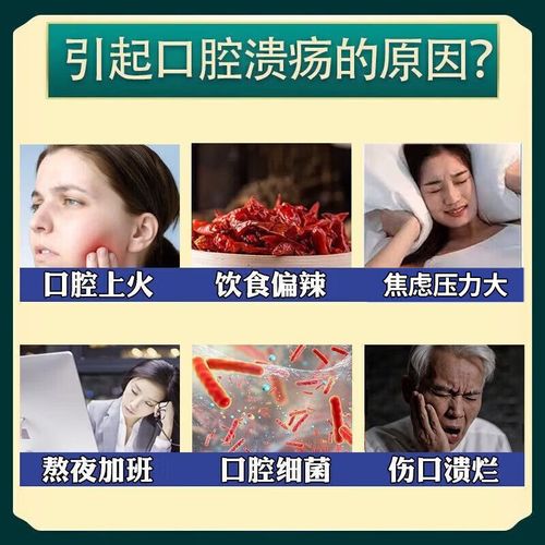 碘甘油真能治口腔溃疡吗?