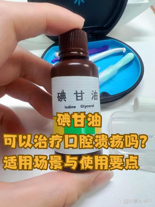 碘甘油真能治口腔溃疡吗?