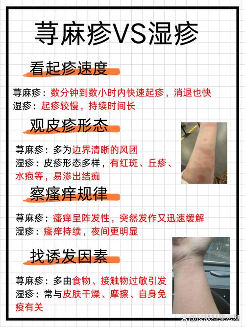 皮肤起痒疙瘩是过敏还是其他问题?