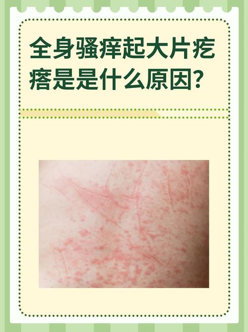 皮肤起痒疙瘩是过敏还是其他问题?