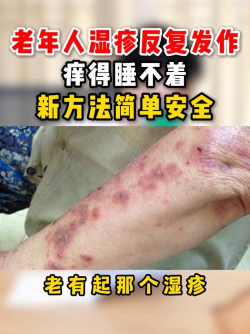 老人皮肤痒是何原因?