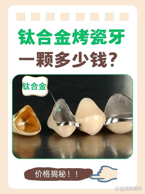 口腔医院烤瓷牙多少钱一颗