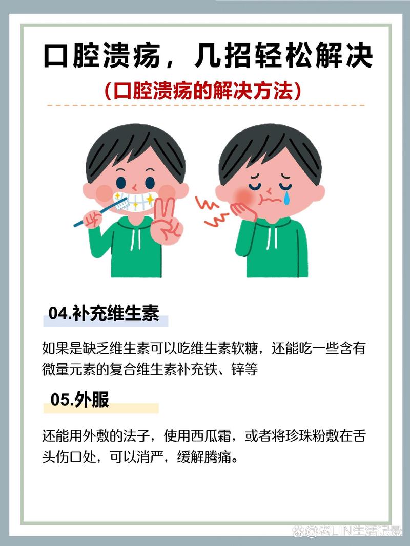 吃东西咬到口腔内侧咋办?