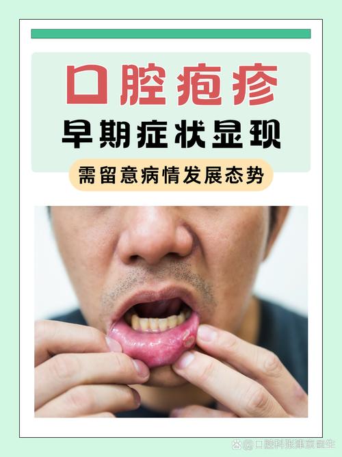 口腔真菌感染因何而起?