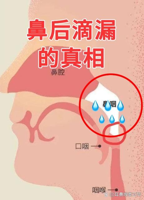 鼻口连接处疼痛,是何原因?