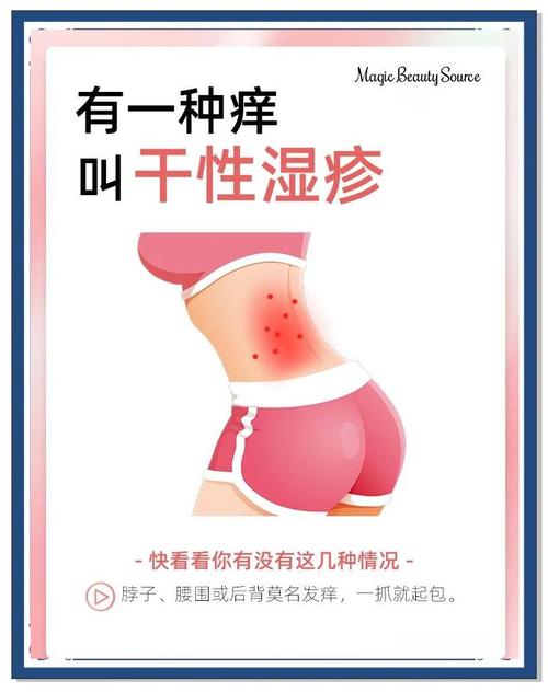 产后皮肤干痒怎么快速缓解?