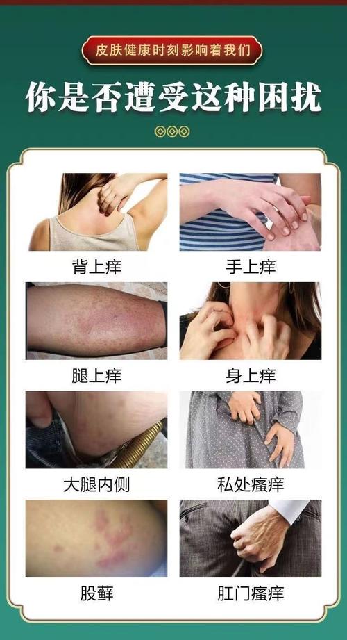 全身皮肤干燥瘙痒,如何快速缓解?