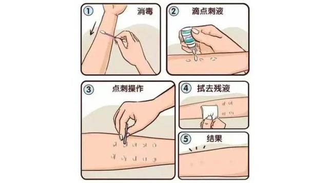 注射部位皮肤消毒的正确方法是什么?