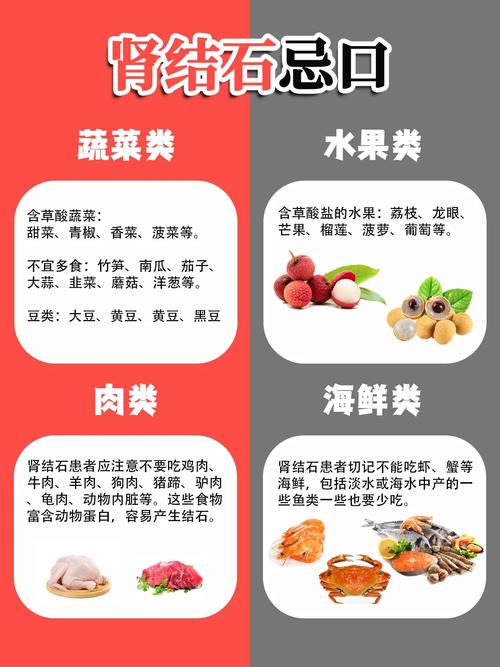 肾结石患者哪些食物绝对不能吃?