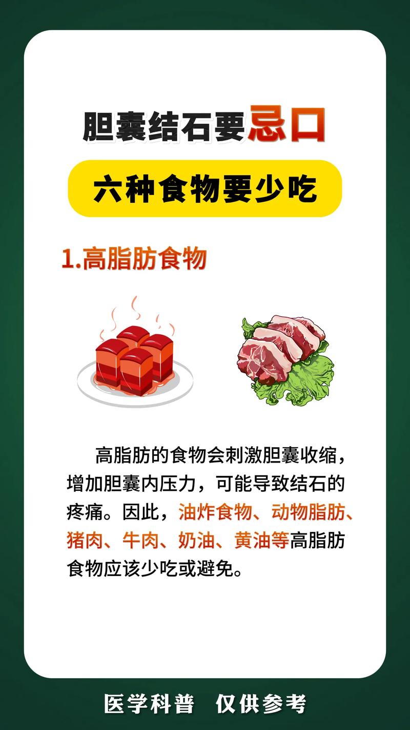 胆结石患者不能吃什么食物