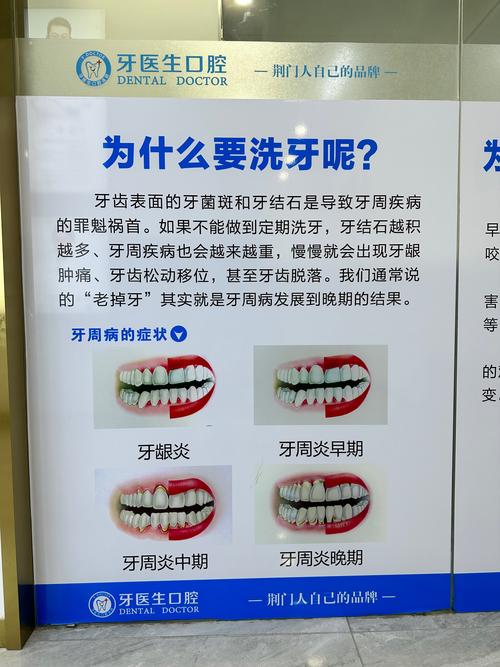 北大口腔医院洗牙挂什么科