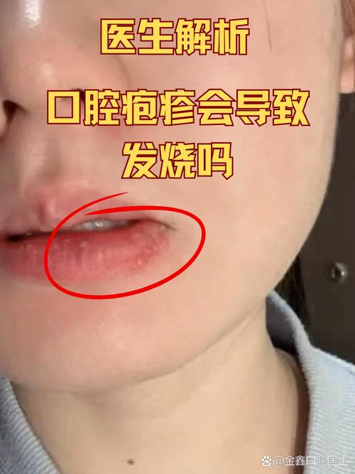 口腔内有小疙瘩是怎么回事