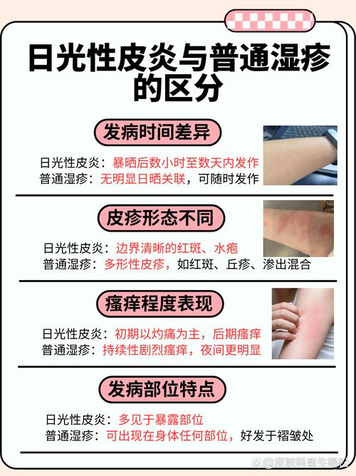 晒太阳皮肤痒是过敏还是缺什么?