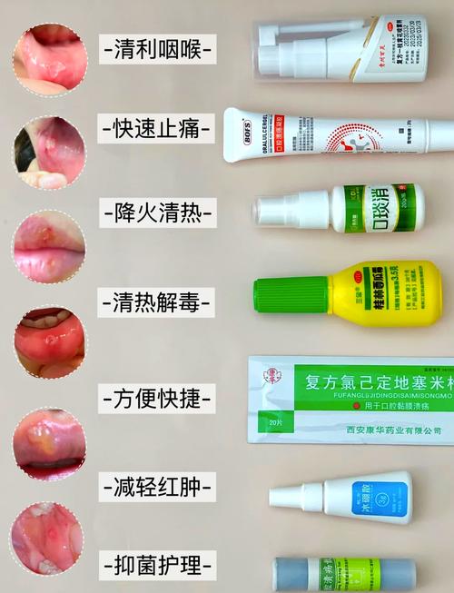 维生素B2能治口腔溃疡吗?