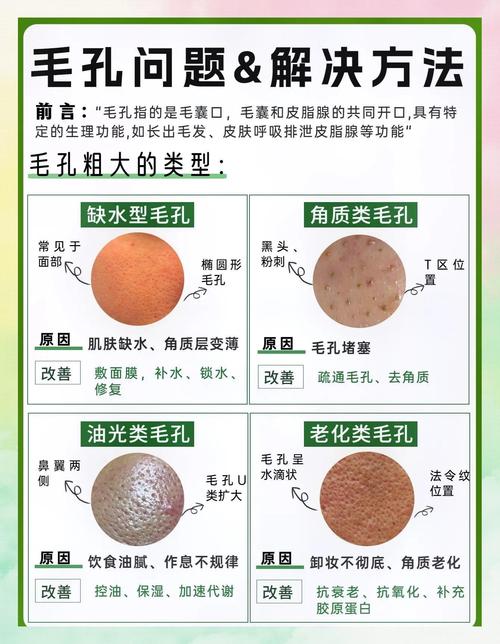 毛孔粗大皮肤油腻怎么办