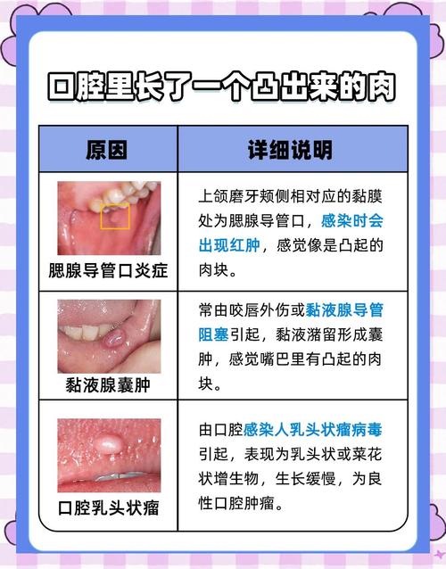 口腔有2个对称的小疙瘩