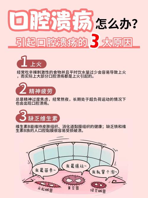 口腔溃疡最快治法是啥?真有速效招?