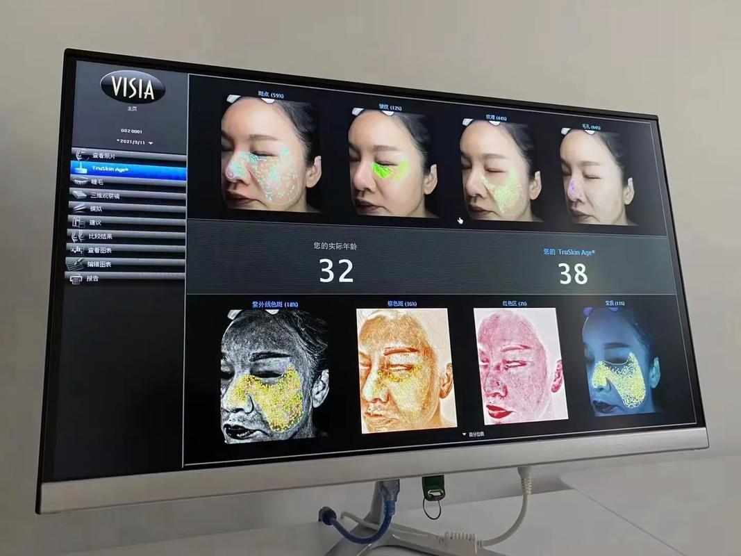 Visiai皮肤检测仪,精准检测还是智商税?