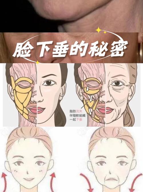 皮肤松弛下垂,如何有效紧致提升?