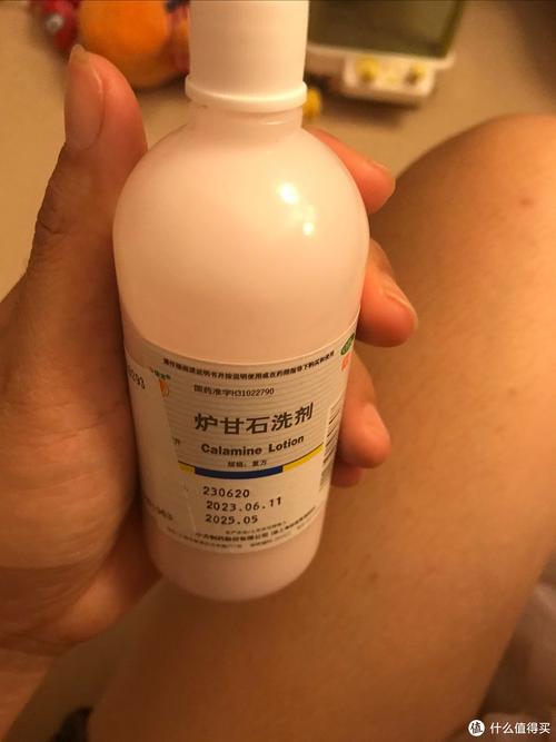 皮肤过敏能用炉甘石吗?