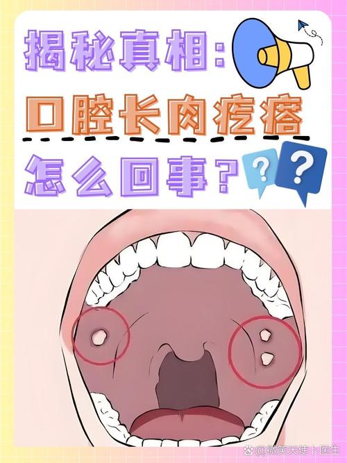 口腔内长肉疙瘩疼是什么原因?