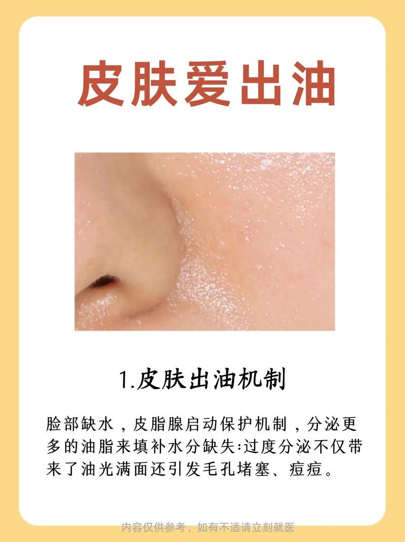 皮肤为何总出油?原因究竟是什么?