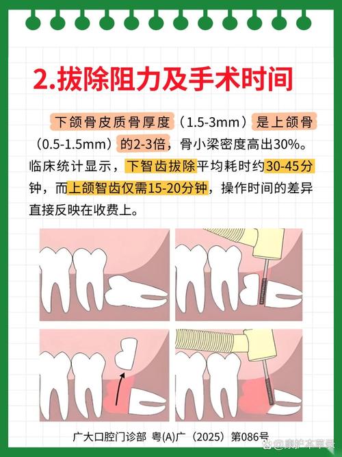 拔一颗牙到底要花多少钱?