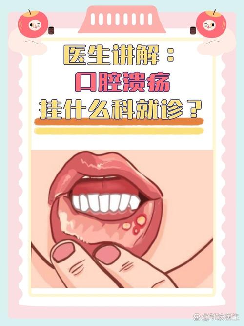 口腔溃疡反复发作该挂哪科?