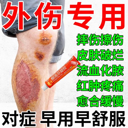 擦伤伤口,抹什么药能加速愈合?